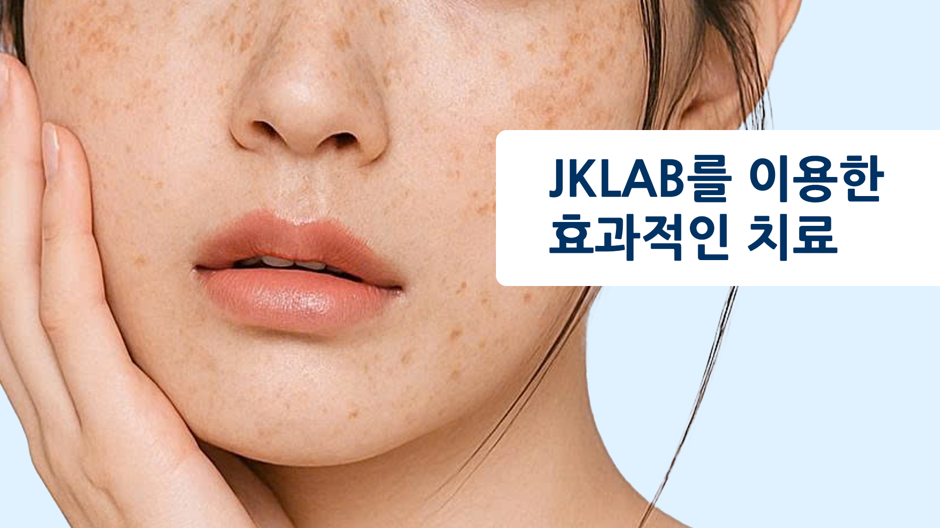 효과적인 기미 치료 루틴은?